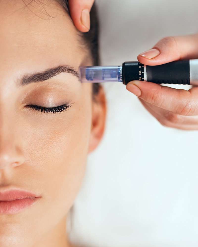 Cosmetologist making mesotherapy injection with dermapen on face